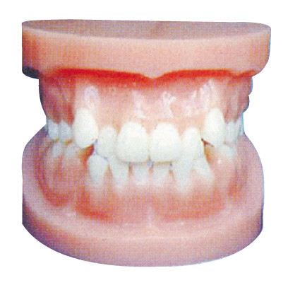O implante dental modela/modelo ortodôntico para o treinamento anatômico